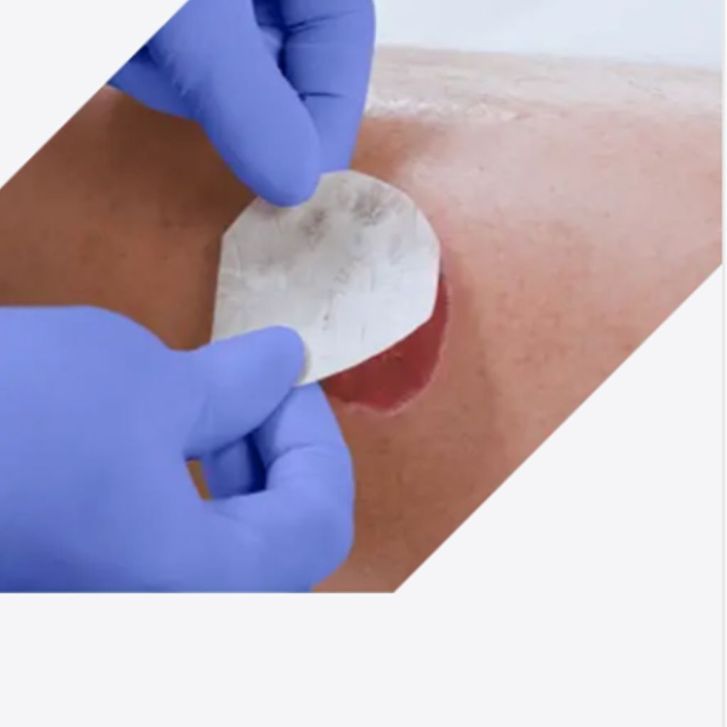 Advanced Wound Care